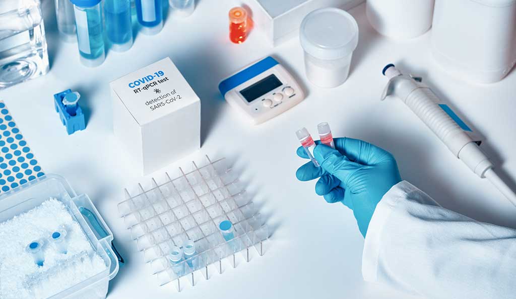Test PCR utilisé pour le diagnostic de COVID-19
