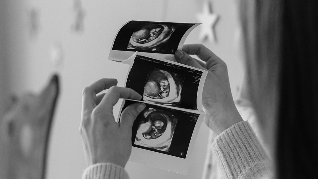 Femme enceinte regardant les clichés d'une échographie de grossesse