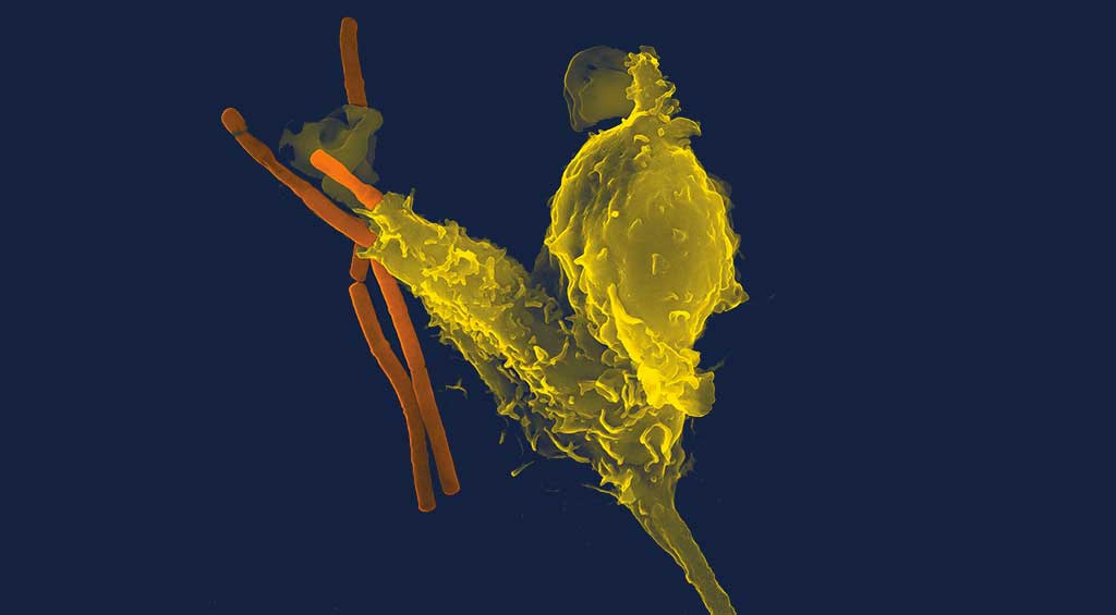 Neutrophile (en jaune) avalant des spécimens de la bactérie Bacillus anthracis (en orange), à l'origine de l'anthrax.