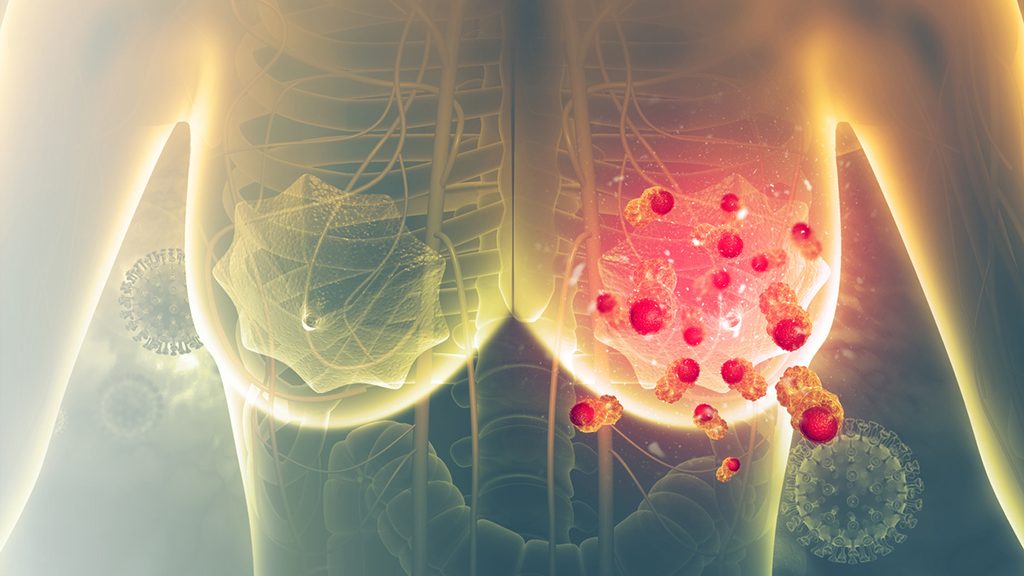 Modélisation en 3D du cancer du sein