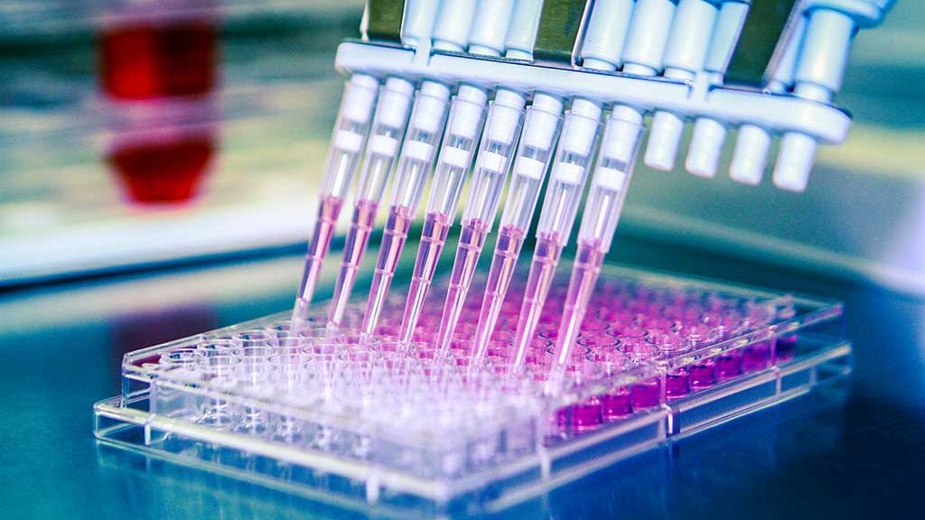 Procédure d'amplification de l'ADN utilisée lors d'un test PCR
