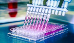 Procédure d'amplification de l'ADN utilisée lors d'un test PCR