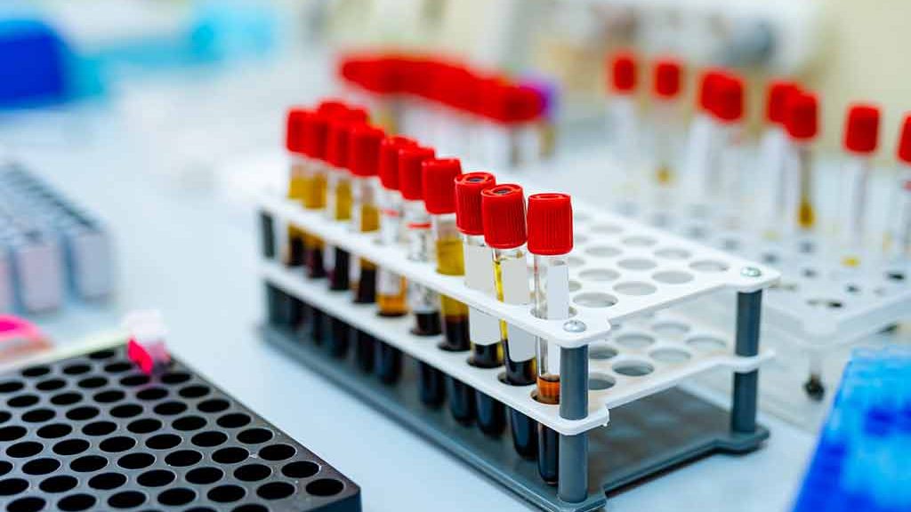 Échantillons de sang en laboratoire