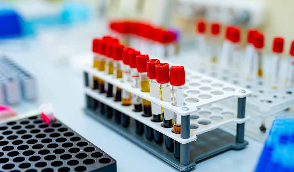 Échantillons de sang en laboratoire