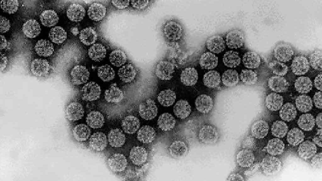Virus simien 40 (SV40)