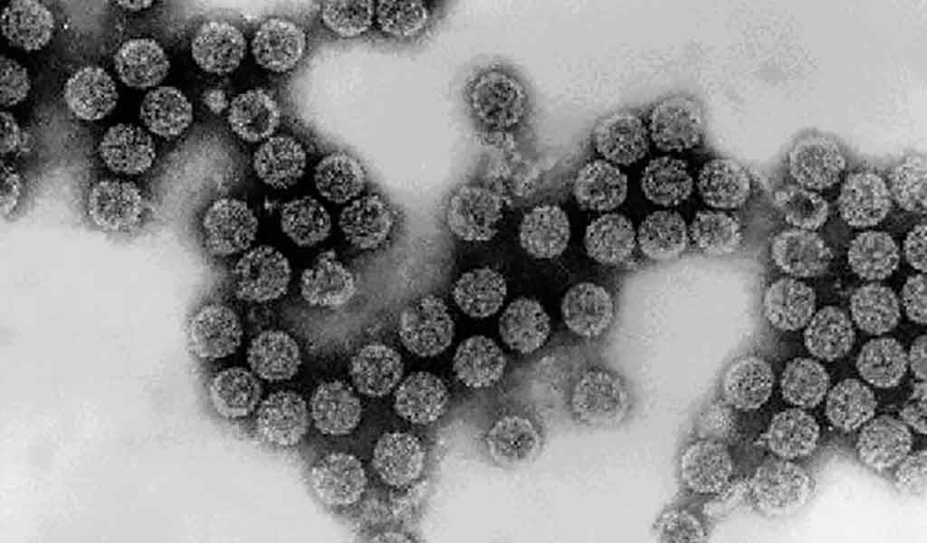Virus simien 40 (SV40)